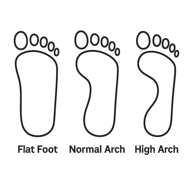 Minimalist illustration of three footprints showing flat foot with no arch, normal arch with moderate curve, and high arch with a narrow midsection.